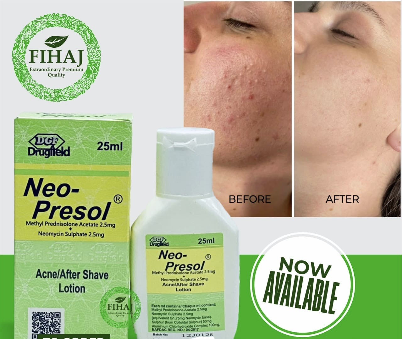 Neo Presol Acne Lotion